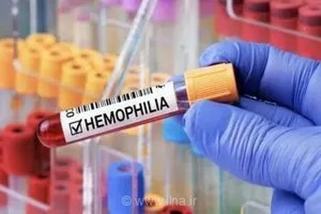 ورود نخستین محموله داروی حیاتی فاکتور XIII برای بیماران هموفیلی طی یک ماه آینده به ایران