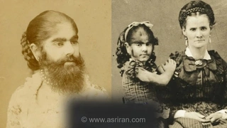 نوزادی که با سبیل به دنیا آمد! داستان عجیب ترین ستاره سیرک های جهان (+عکس)