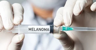 واکسن جدید mRNA کاهش بیش از 40 درصدی خطر بازگشت سرطان melanoma را به دنبال دارد