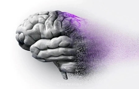 افزایش ابتلای جوانان به آلزایمر پس از دوران کرونا/ یک میلیون و ۵۰۰ هزار مبتلا در ایران
