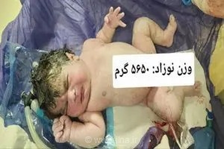 تولد نوزاد ۵ کیلو و ۶۵۰ گرمی در کرمانشاه؛ زایمان موفق مادر ۲۷ ساله در بیمارستان امام رضا(ع)
