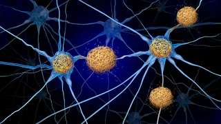 محققان ممکن است برای دهه‌ها عامل پنهان بیماری آلزایمر را نادیده گرفته باشند