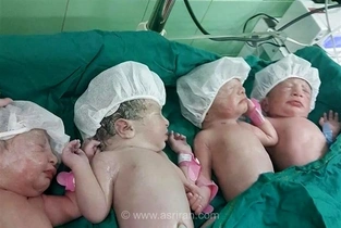 ثبت 6 زایمان چندقلویی در سنندج؛ تولد 15 نوزاد در یک روز