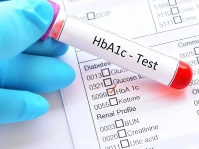آزمایش HbA1c چیست و چگونه میانگین قند خون سه ماه گذشته را نشان می‌دهد؟