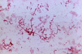 عامل بیماری طاعون: باکتری Yersinia pestis در تصویر میکروسکوپی