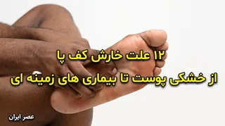 ۱۲ علت خارش کف پا؛ از خشکی پوست تا بیماری‌های زمینه‌ای