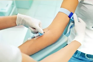 انجام عمل رگ‌گیری برای چه افرادی مناسب است؟