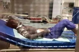 آخرین وضعیت دو کارگر حادثه پمپ بنزین زابل؛ انتقال مصدوم با سوختگی شدید به مشهد برای ادامه درمان