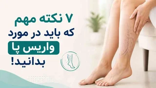 ۷ نکته مهم که باید در مورد واریس پا بدانید!