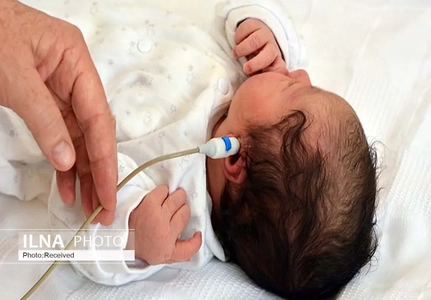 غربالگری شنوایی ۹۹ درصد نوزادان فارس؛ شناسایی ۱۶۸ کودک کم‌شنوا