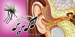 چرا پشه‌ها به سمت گوش انسان جذب می‌شوند؟