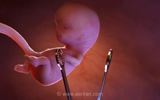 سالانه ۱۱ هزار درخواست سقط جنین قانونی در ایران ثبت می‌شود