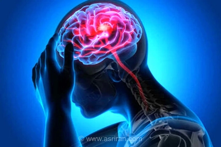 سکته مغزی: علائم هشداردهنده و تفاوت سکته ایسکمیک با خونریزی