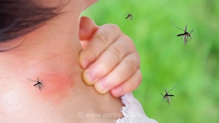 گزش حشرات در کودکان: علائم هشداردهنده و زمان مراجعه به پزشک