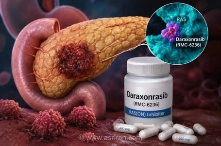 تأییدیه FDA برای داروی جدید درمان سرطان لوزالمعده؛ امید تازه‌ای برای بیماران