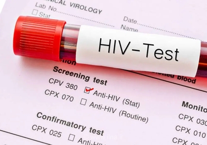 افزایش انتقال HIV از طریق روابط جنسی؛ نگرانی از روند ابتلا در زنان