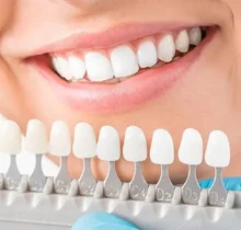 بلیچینگ دندان: اصول علمی و ملاحظات بالینی