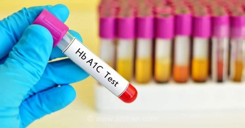 HbA1c: شاخصی برای تشخیص قند خون و خطر ابتلا به دیابت