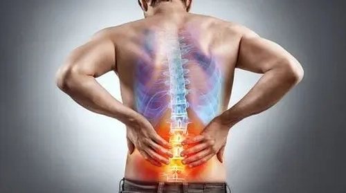 دیسک کمر: جراحی همیشه راه حل نیست