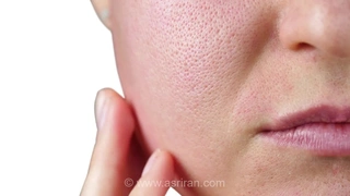 چرا منافذ پوست صورت یکسان نیستند؟ حقایقی علمی درباره ساختار پوست که باید بدانید (+اینفوگرافیک)