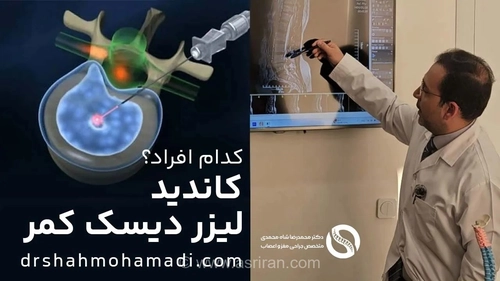 چه کسانی کاندیدای مناسب درمان لیزری دیسک کمر هستند؟