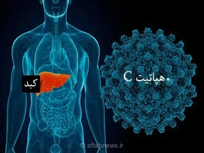 هپاتیت C بیماری خاموش؛ امکان درمان با داروهای خوراکی علی‌رغم نبود واکسن پیشگیرانه