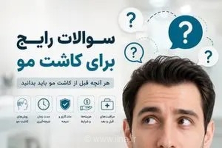راهنمای جامع انتخاب کلینیک کاشت مو: ۵ سوال حیاتی که پیش از اقدام باید از پزشک خود بپرسید