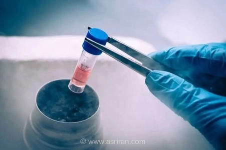 امکان فریز تخمک برای زنان مجرد بالای ۳۰ سال؛ نیازمندی به نگاه جامع به سلامت باروری