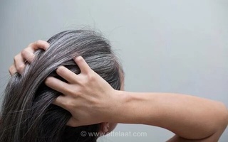 دلایل سفیدی مو و راه‌های پیشگیری از آن
