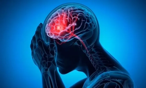 هشدار وزارت بهداشت درباره سکته مغزی؛ هر دقیقه تاخیر می‌تواند سرنوشت بیمار را تغییر دهد