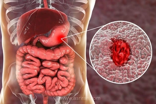 چرا سلامت دستگاه گوارش نقش کلیدی در وضعیت عمومی بدن و کیفیت زندگی ایفا می‌کند؟